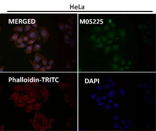 Anti-USP11 Monoklonale antilichamen