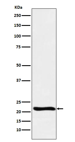Anti-GLO1 Monoklonale Antilichaam