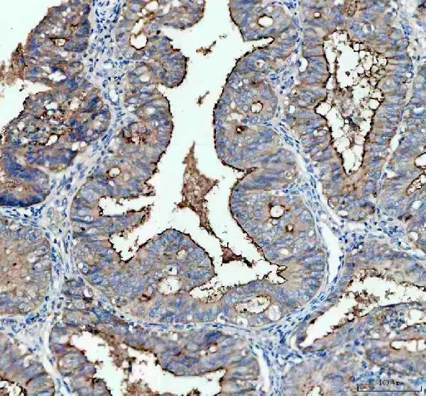 Anti-CA125 / MUC16 Monoklonale Antilichaam