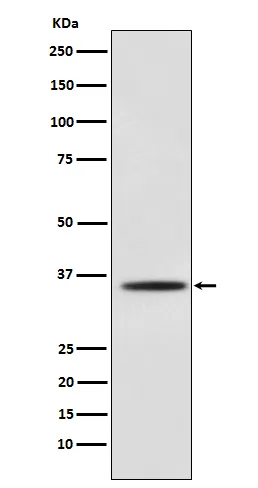 Anti-Myogenine Monoklonale Antilichaam