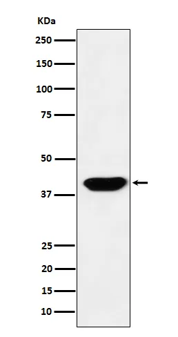 Anti-Islet1 Monoklonaal antilichaam