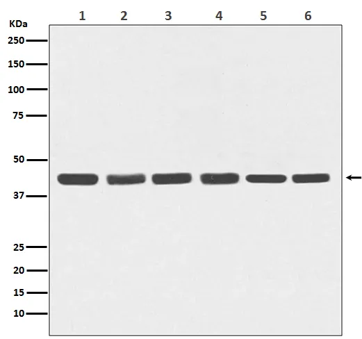 Anti-beta Actin Mouse Monoklonale Antilichaam