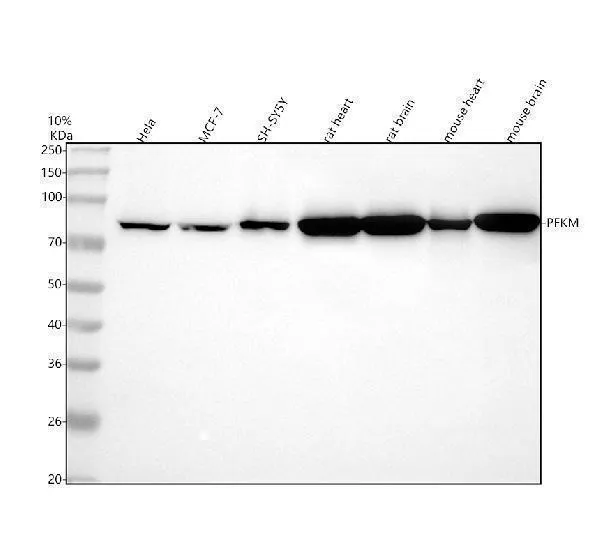 Anti-fructose 6 Fosfaat Kinase Konijn Monoklonale Antilichaam