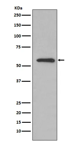 Anti-glucose 6 fosfaat isomerase Konijn Monoklonale Antilichaam