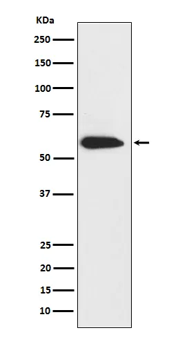 Anti-Cytokeratin 6 Konijn Monoklonale Antilichaam