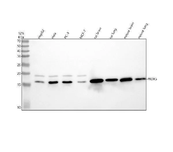 Anti-Peroxiredoxin 5 Konijn Monoklonale Antilichaam