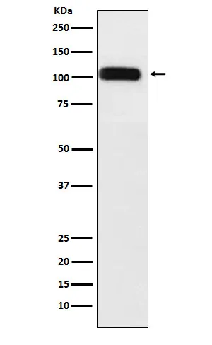 Anti-SERCA1 ATPase Konijn Monoklonale Antilichaam