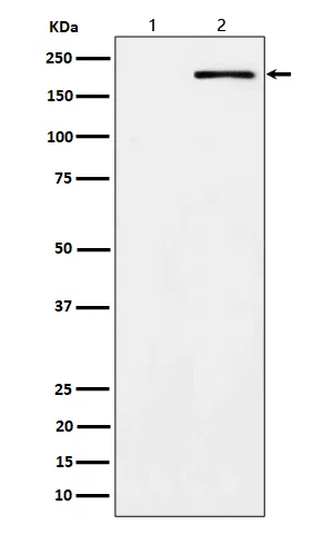 Anti-Phospho-ErbB2 (Y1139) Konijn Monoklonale Antilichaam