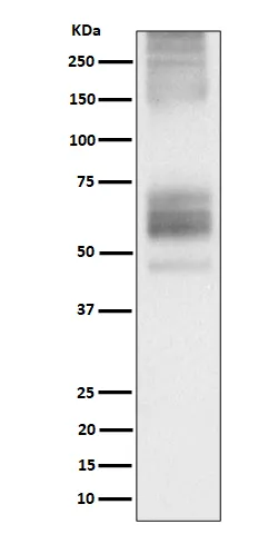 Anti-Somatostatine Receptor 1 Konijn Monoklonale Antilichaam