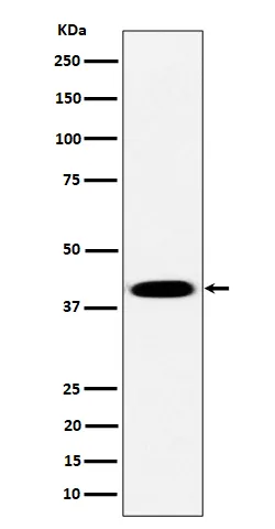 Anti-Pleckstrin Rabbit Monoklonale Antilichaam