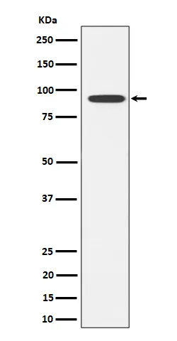 Anti-Glyt2 Konijn Monoklonale Antilichaam