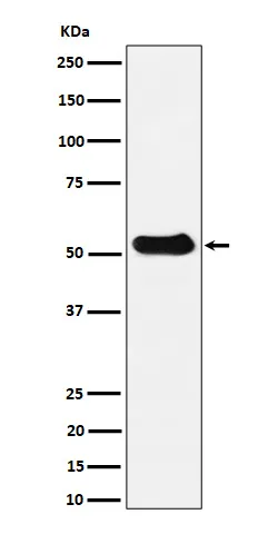 Anti-alfa Tubuline (acetyl K40) Konijn Monoklonale Antilichaam