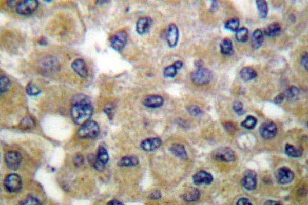 Anti-Mammaglobine B (K23) SCGB2A1 Antilichaam