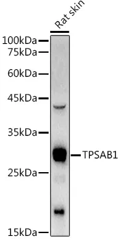 Anti-Tryptase alfa/beta-1 TPSAB1 Antilichaam