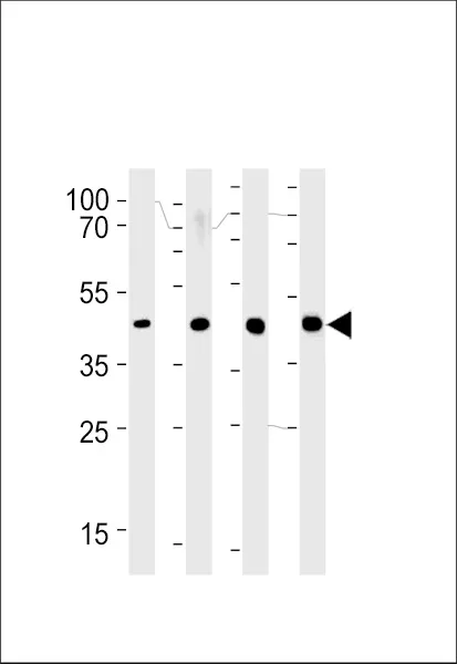 Anti-SRD5A3 Antilichaam (C-term)