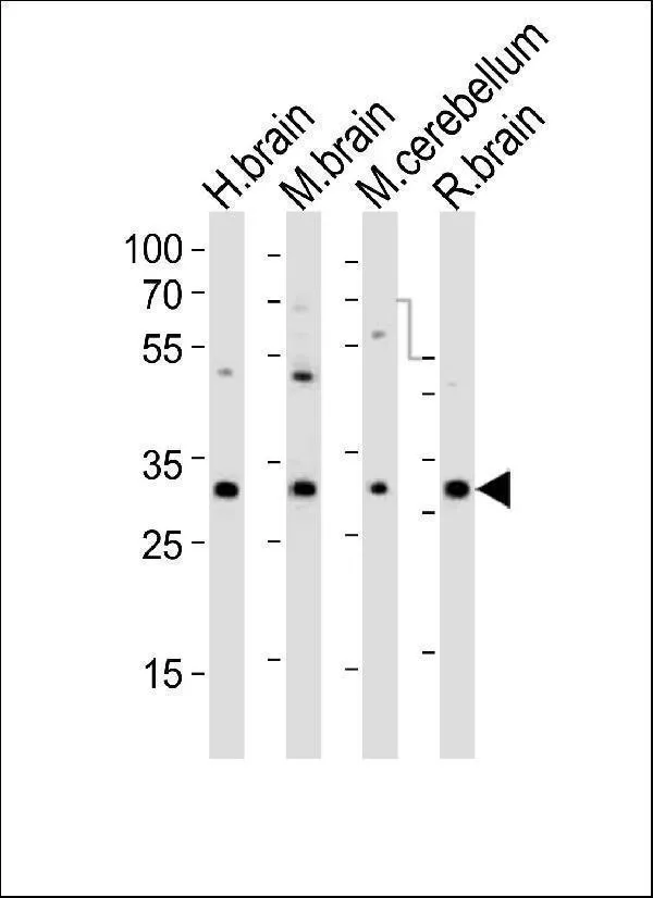 Anti-PCGF1 Antilichaam (Center)