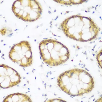 Anti-BRD9 Antilichaam