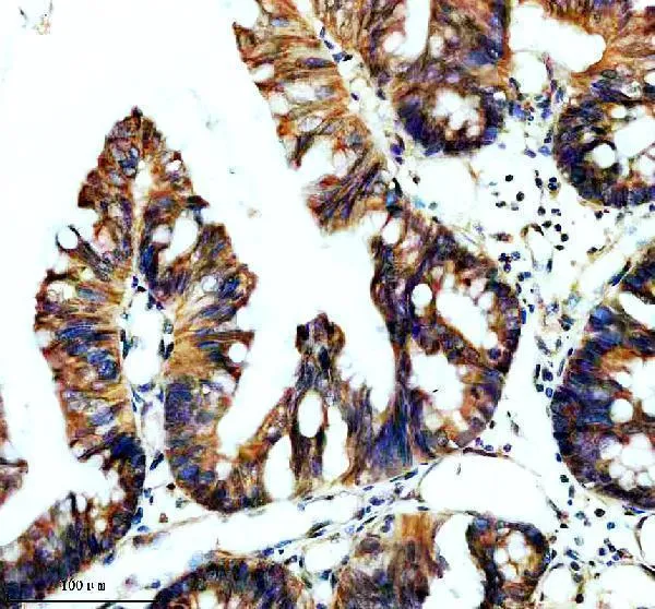 Anti-TBC1D5 Antilichaam