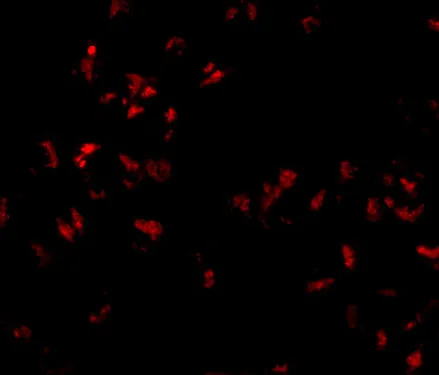 Anti-SCARA5 Antilichaam