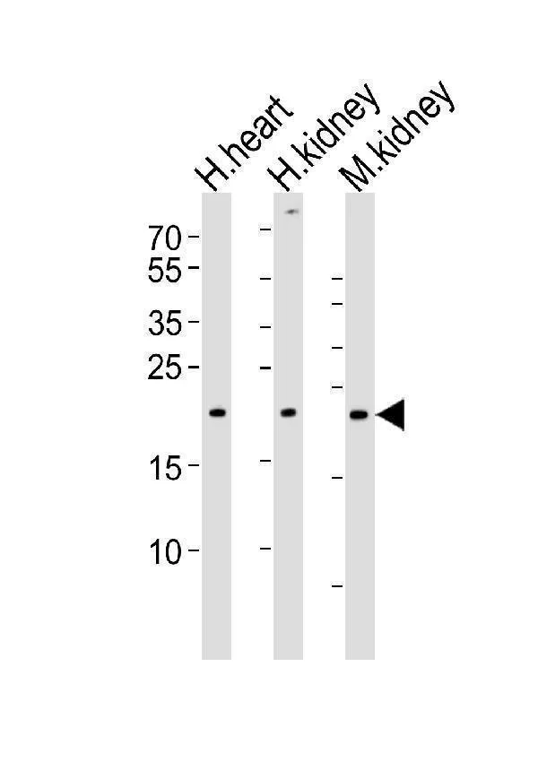 Anti-CYS1 Antilichaam (C-term)