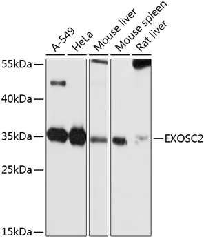 Anti-EXOSC2 Antilichaam
