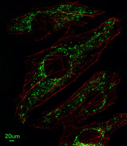Anti-SLC25A37 Antilichaam (C-term)