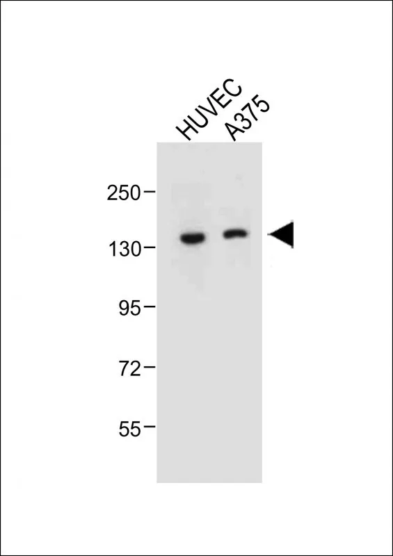 Anti-TECPR1 Antilichaam (C-termijn)