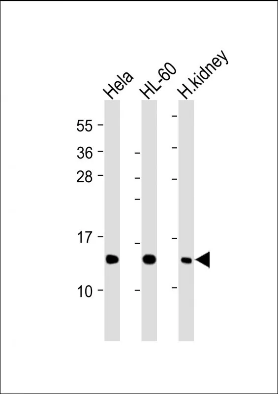 Anti-ND4L-antilichaam (C-term)