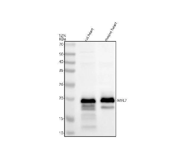 Anti-MYL7 Antilichaam