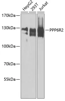 Anti-PPP6R2 Antilichaam