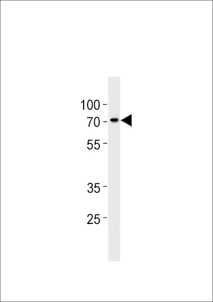 Anti-ST7L-antilichaam (C-term)
