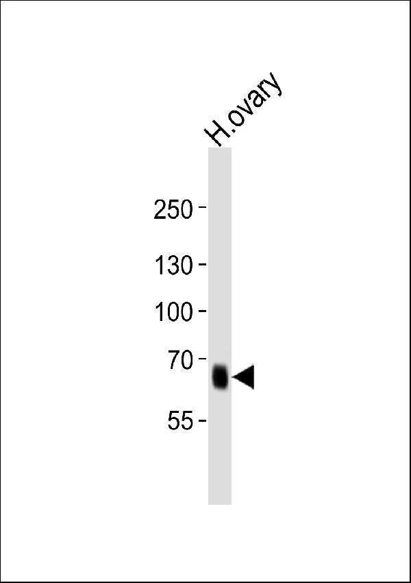 Anti-PRDM13 Antilichaam (N-term)