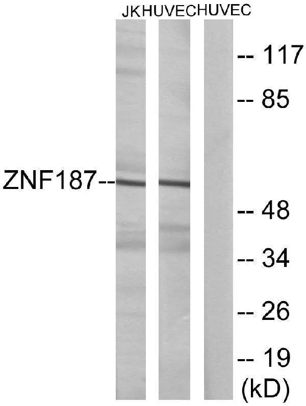 Anti-SRE-ZBP ZSCAN26 Antilichaam