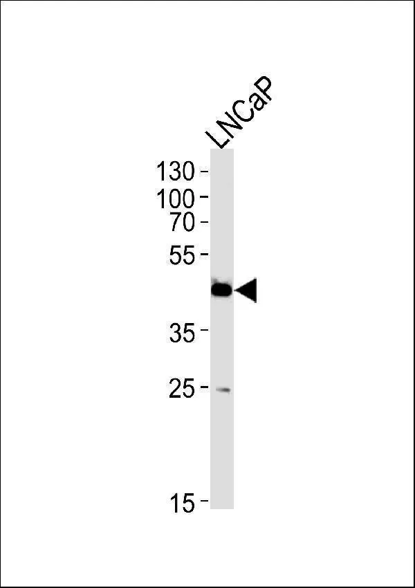 Anti-FAM54A Antilichaam (C-term)
