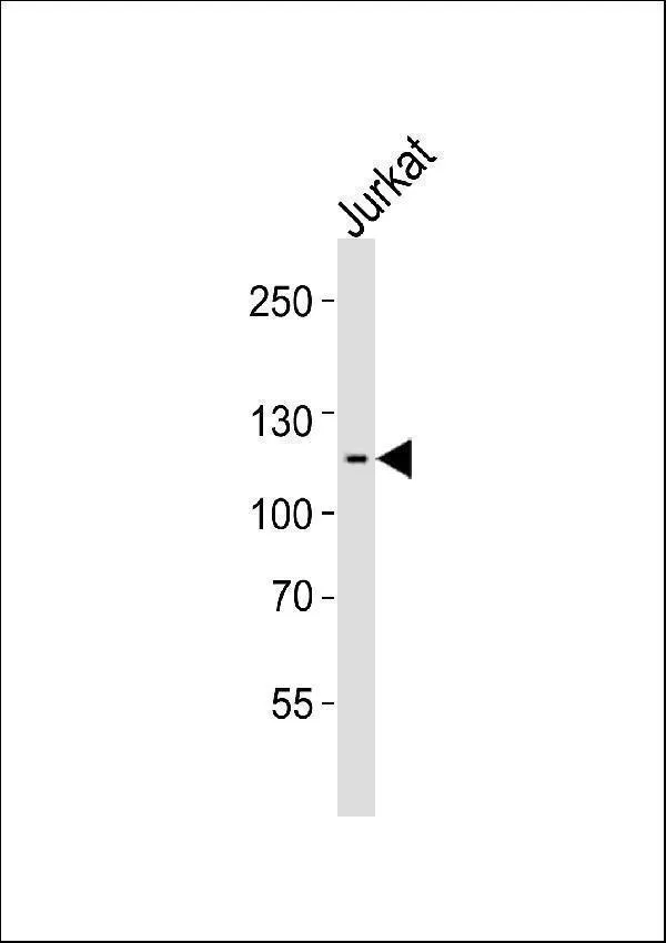 Anti-ZNF624 Antilichaam (Center)