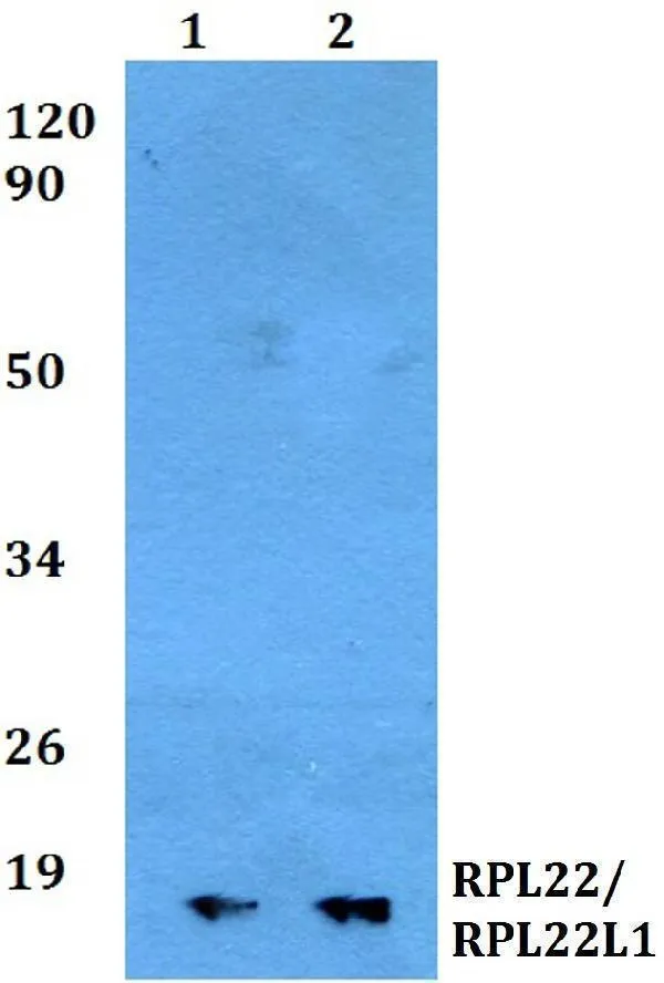 Anti-RPL22/RPL22L1 Antilichaam