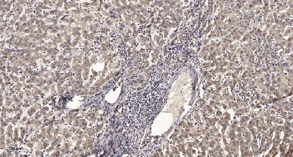 Anti-RING vingereiwit 113B RNF113B Antilichaam