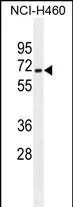 Anti-ZSCAN5B Antilichaam (C-term)