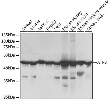 Anti-ATP5B ATP5F1B Antilichaam