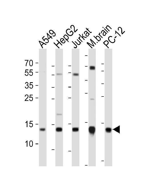 Anti-ATP5D-antilichaam (C-term)