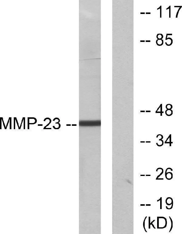 Anti-MMP-23 Antilichaam