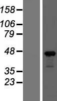 Beta Actin (ACTB) (NM 001101) Humane overexpressie Lysaat