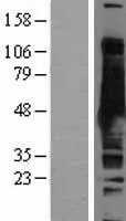 S adenosylhomocysteïnehydrolase (AHCY) (NM 000687) Humane overexpressielysaat