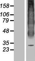 Aquaporine 6 (AQP6) (NM 001652) Humane overexpressie Lysaat