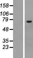 Asparaginesynthetase (ASNS) (NM 133436) Humane overexpressie Lysaat