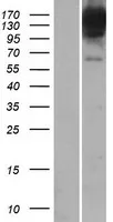 BICD1 (NM 001714) Humane overexpressie Lysaat