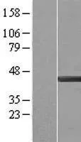 Actin Regulatory Protein CAPG (CAPG) (NM 001747) Human Over-expression Lysate
