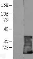 CD247 (NM 198053) Human Over-expression Lysate