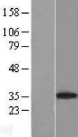 CD8A (NM 001768) Human Over-expression Lysate