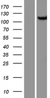 Cellulaire apoptose Gevoeligheid (CSE1L) (NM 001316) Humane overexpressie Lysaat